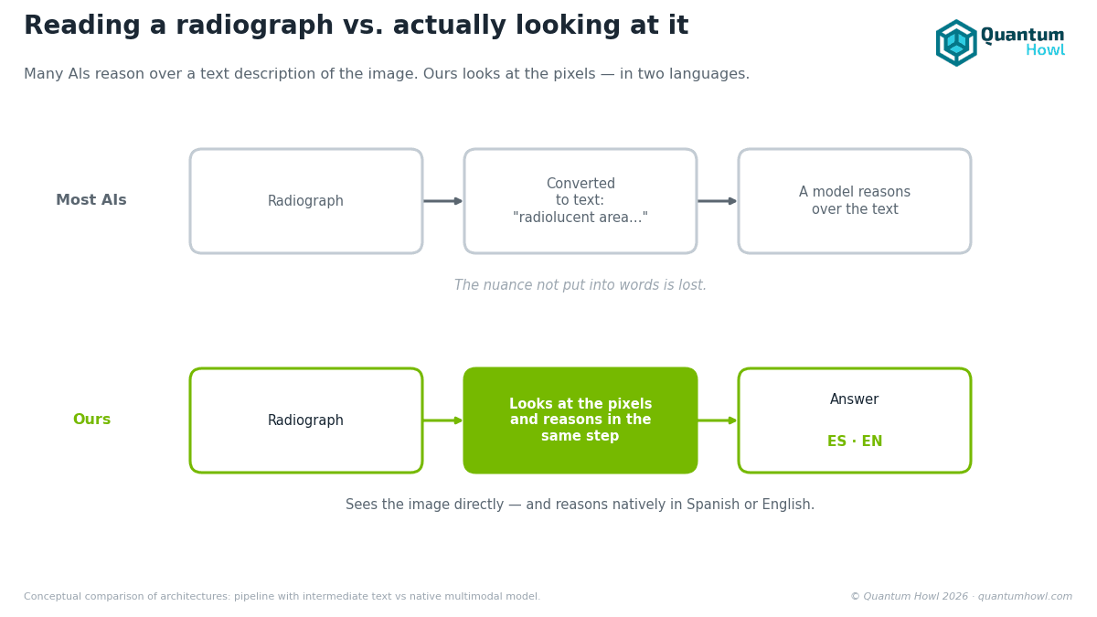 Most AIs that «read» X-rays never actually look at them. Ours does