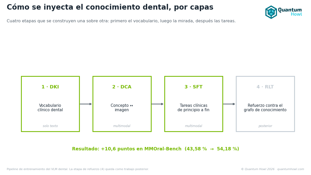 Cómo se le enseña odontología a un modelo de IA, paso a paso