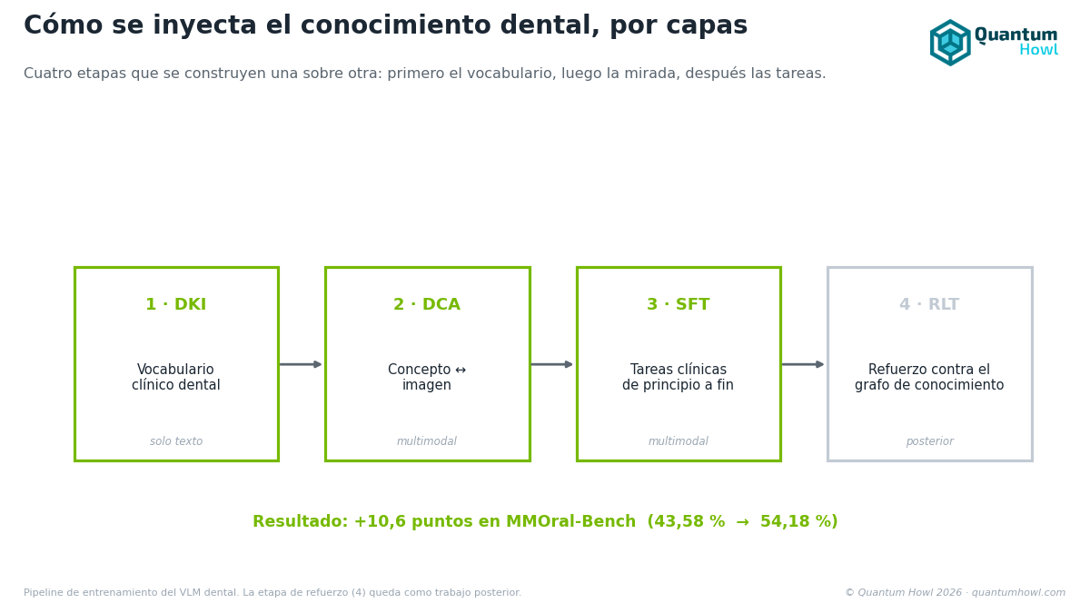 Las cuatro etapas del entrenamiento del VLM dental: DKI (vocabulario), DCA (concepto-imagen), SFT (tareas clínicas) y RLT (refuerzo), que suben la precisión +10,6 puntos en MMOral-Bench.