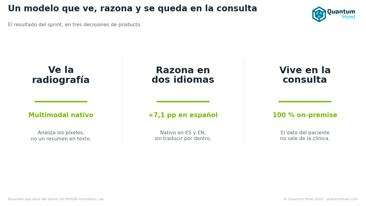 Tres pilares del modelo dental: ve la radiografía (multimodal nativo), razona en dos idiomas (+7,1 pp en español) y vive en la consulta (100 % on-premise).